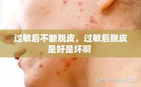 过敏后不断脱皮，过敏后脱皮是好是坏啊 