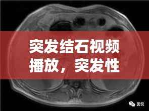突发结石视频播放,突发性结石