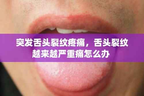突发舌头裂纹疼痛，舌头裂纹越来越严重痛怎么办 