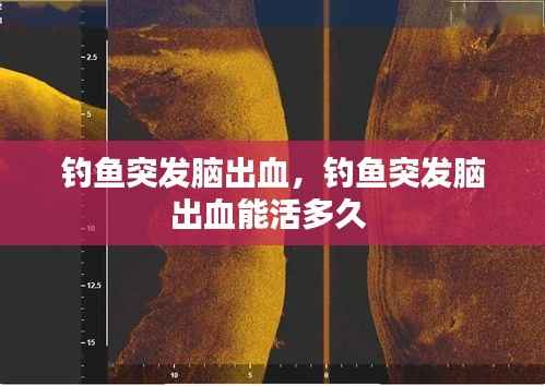 钓鱼突发脑出血，钓鱼突发脑出血能活多久 