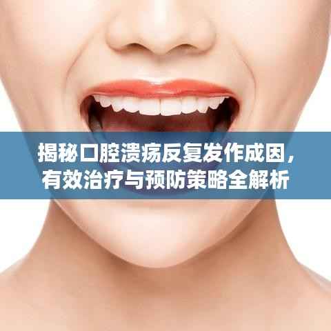 揭秘口腔溃疡反复发作成因，有效治疗与预防策略全解析