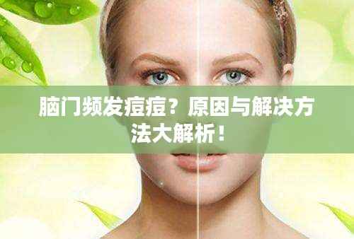 脑门频发痘痘？原因与解决方法大解析！